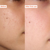 Before and after comparison of skin texture with 'Before' on left and 'After first use' on right.