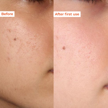 Before and after comparison of skin texture with 'Before' on left and 'After first use' on right.